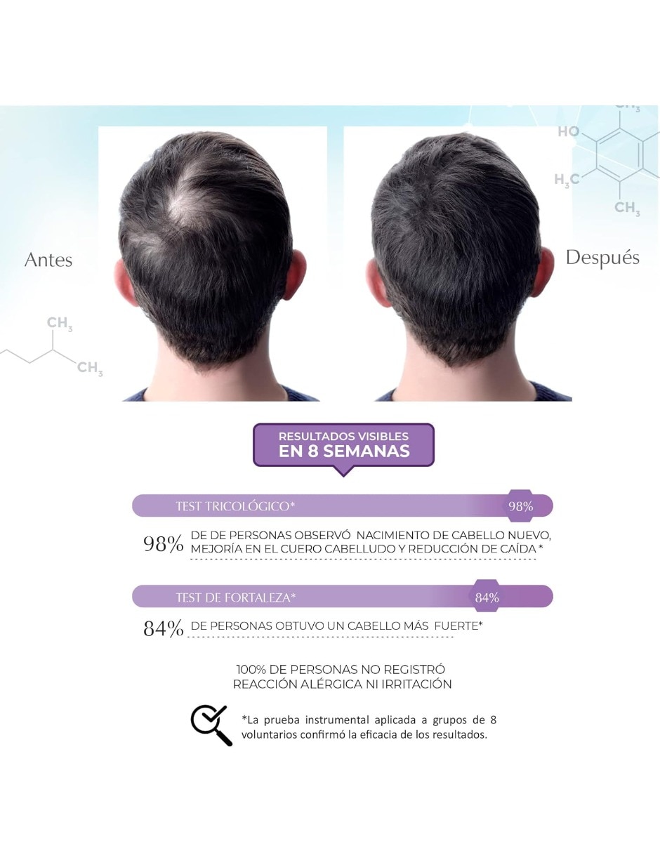 Set de shampoo para cabello todo tipo Science Advance Marie D' Argan 8