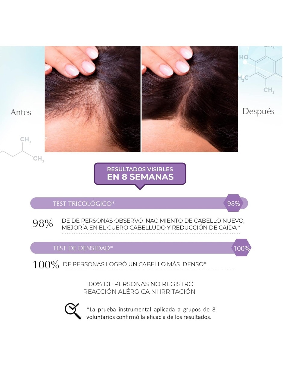 Set de shampoo para cabello todo tipo Science Advance Marie D' Argan 7